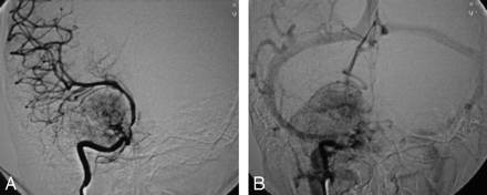 Fig 3.