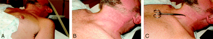 Fig 1.