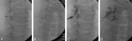 Fig 2.