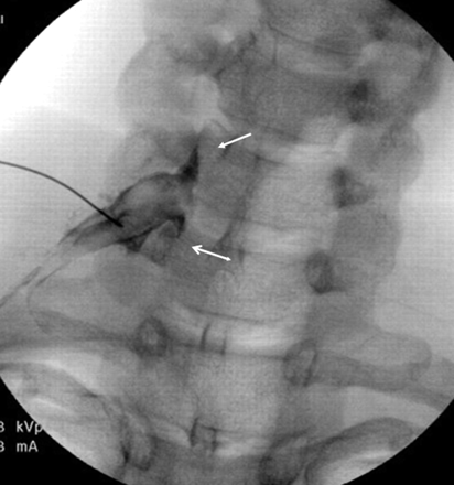 Fig 3.