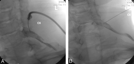 Fig 4.