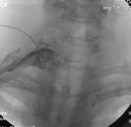 Fig 5.