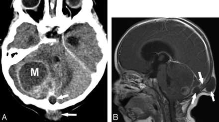 Fig 2.
