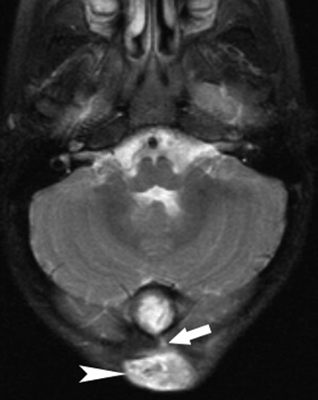 Fig 3.