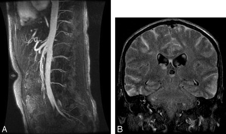 Fig 2.