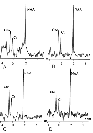 Fig 2.