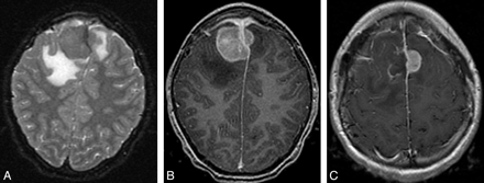 Fig 1.
