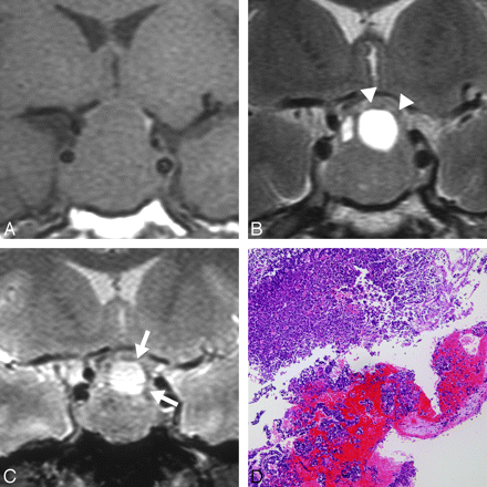Fig 3.