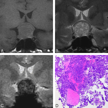 Fig 4.
