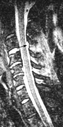Fig 8.