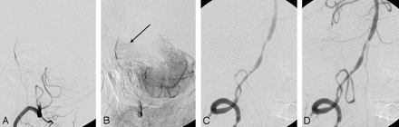 Fig 3.