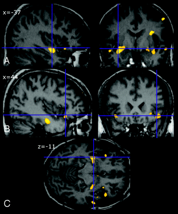Fig 1.