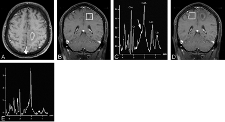 Fig 1.