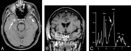 Fig 4.