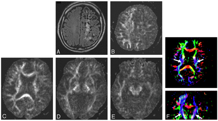   Fig 1. 