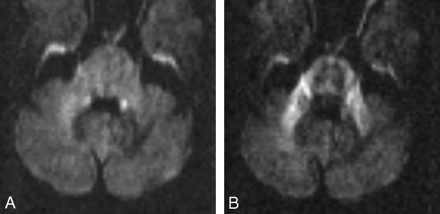 Fig 2.