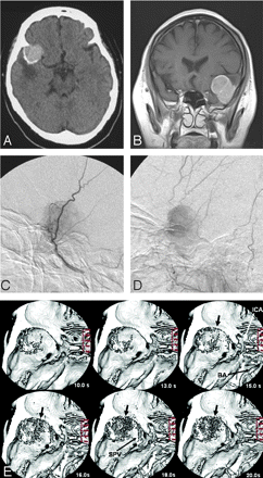 Fig 1.