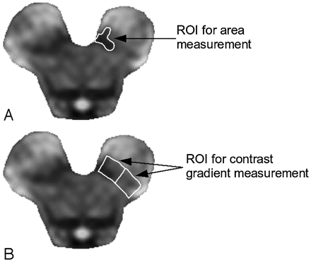 Fig 1.