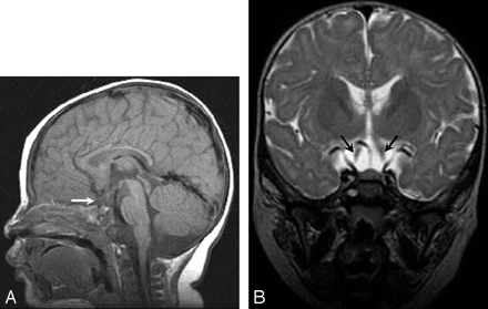 Fig 2.