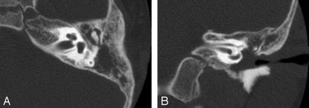 Fig 2.