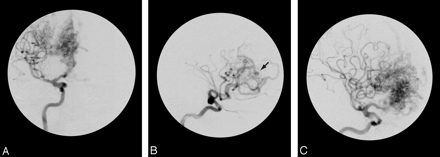 Fig 2.