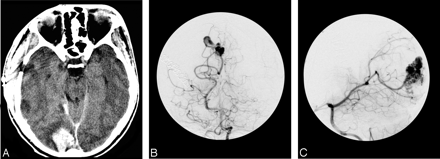 Fig 3.