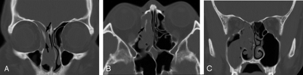 Fig 1.
