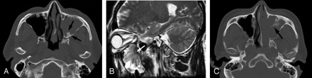 Fig 2.