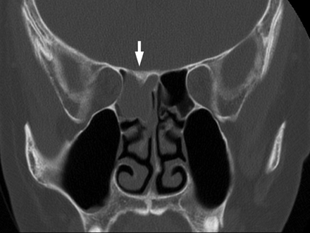 Fig 3.