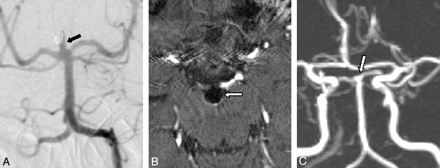 Fig 4.