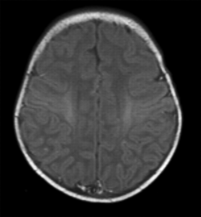Fig 4.