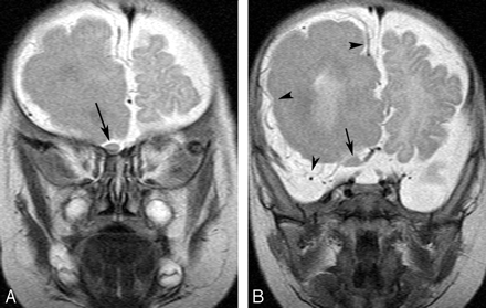 Fig 1.