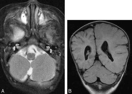 Fig 6.