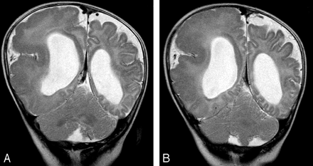 Fig 7.