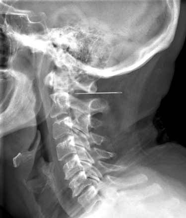 Fig 1.