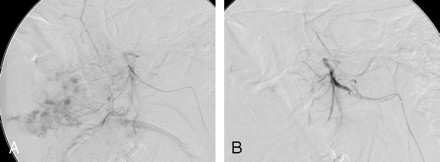 Fig 1.