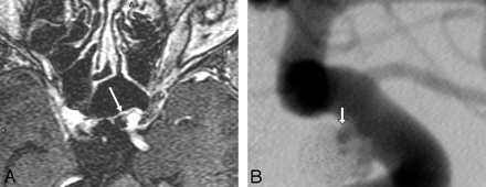 Fig 5.