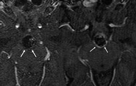 Fig 6.
