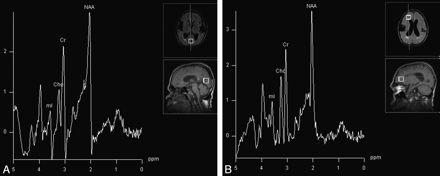 Fig 3.