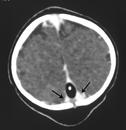 Fig 1.