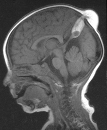 Fig 2.