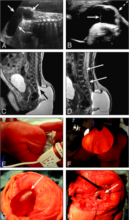 Fig 1.