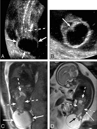 Fig 2.