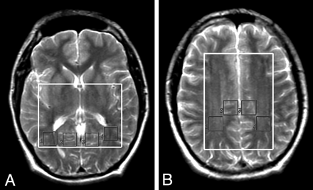Fig 2.