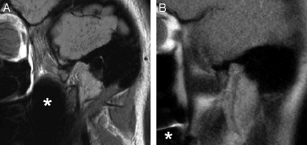 Fig 3.