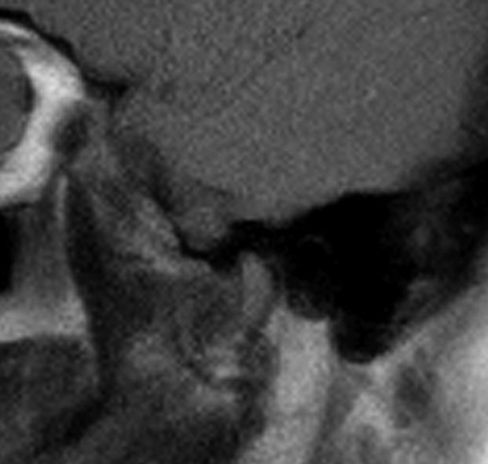 Fig 4.