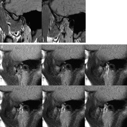Fig 5.
