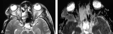 Fig 5.
