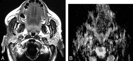 Fig 7.