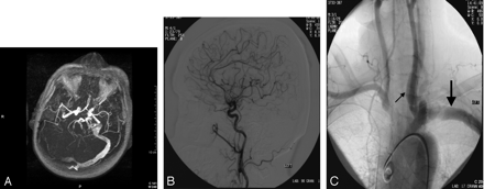 Fig 1.